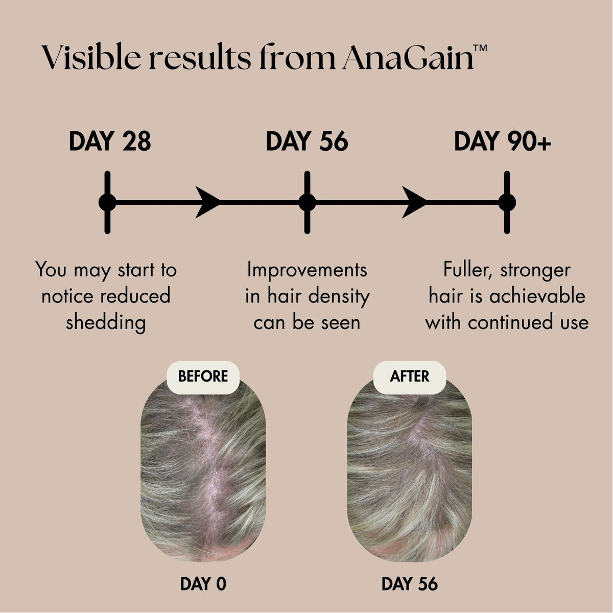 Anavive Hair Nutrition - 1 Month Supply