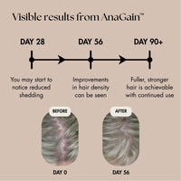 Anavive Hair Nutrition - 1 Month Supply