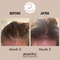 Anavive Hair Nutrition - 1 Month Supply
